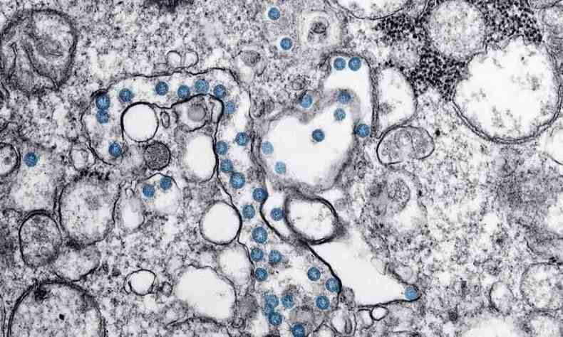 Mdico infectologista destaca que  errado chamar a doena de fungo preto ou fungo negro(foto: CDC/Unsplash)
