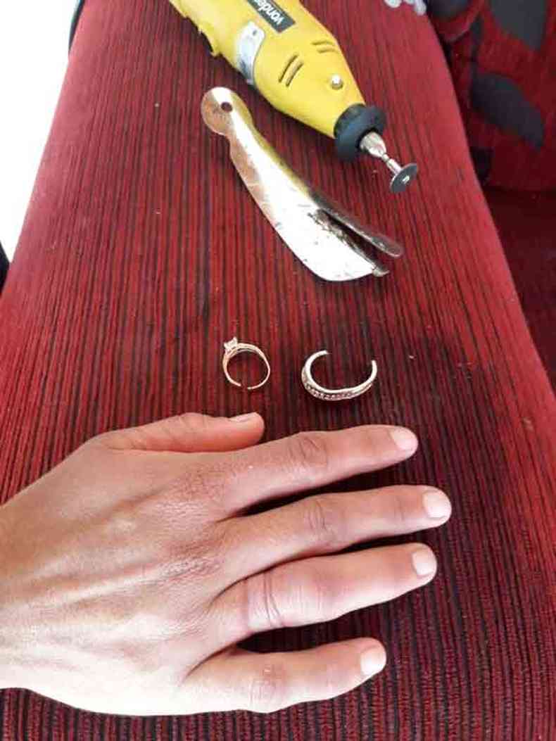Vtima sofreu uma contuso e o dedo inchou, impedindo a retiradas das joias(foto: Corpo de Bombeiros/Divulgao)
