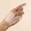 Dia Mundial do Vitiligo: mais de um milhão de brasileiros têm a doença