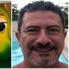 Veja os riscos do aneurisma cerebral, que levou à morte de Tom Veiga