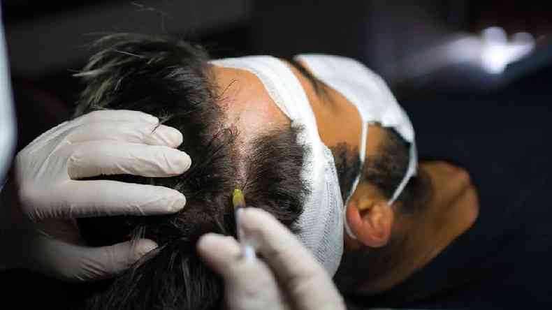 Homem recebendo injeção no couro cabeludo