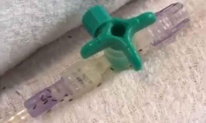 Os insetos também foram encontrados em tubos de acesso para injeção de remédios e sondas de oxigênio (foto: Reprodução/ Internet/ Youtube ) Os insetos também foram encontrados em tubos de acesso para injeção de remédios e sondas de oxigênio (foto: Reprodução/ Internet/ Youtube )