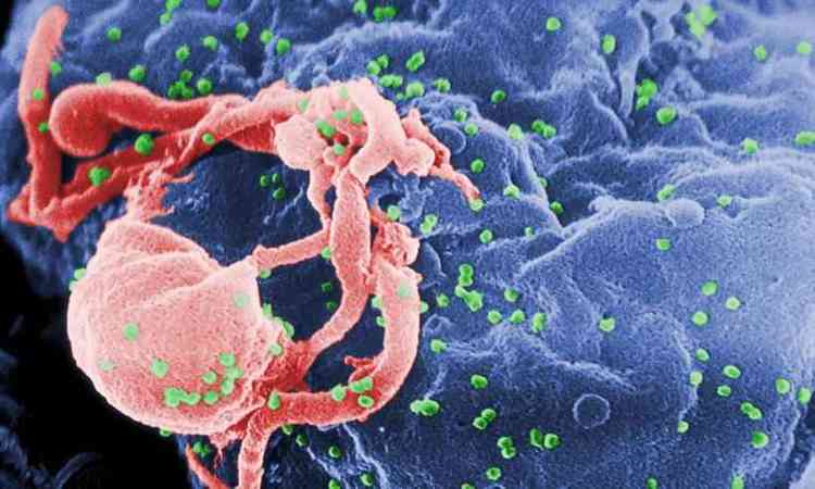 Foto feita por tecnologia com vrus HIV em cores artificiais