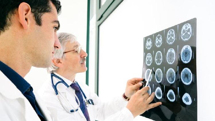 Mdicos observam scanner cerebral