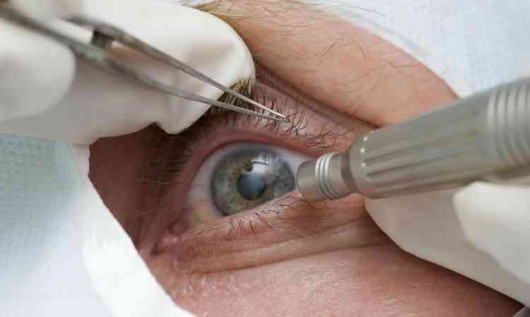 cirurgia oftalmolgica