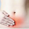 Conheça os impactos da endometriose na vida da mulher