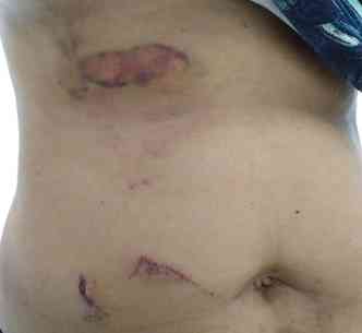 Mulher sofreu tortura e cortes pelo corpo(foto: fotos: Redes sociais/divulgao)
