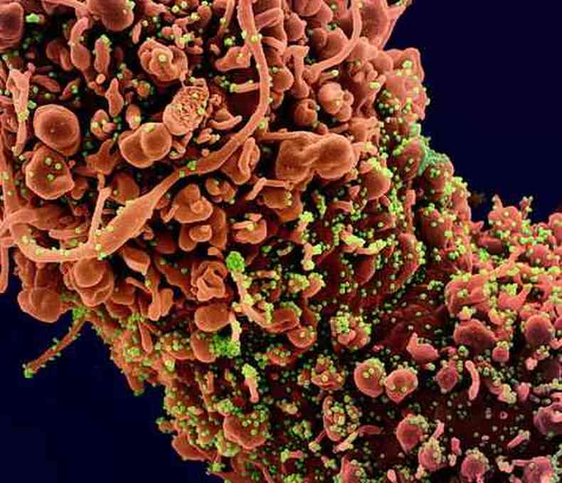 Ilustrao do Instituto Nacional de Alergias e Doenas Infecciosas dos EUA mostra ataque do coronavrus a clulas humanas(foto: EPA/divulgao)