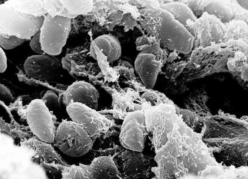 Bactria Yersinia pestis(foto: Wikipedia/Reproduo)