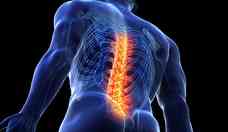 5 coisas que voc deveria saber sobre dores nas costas