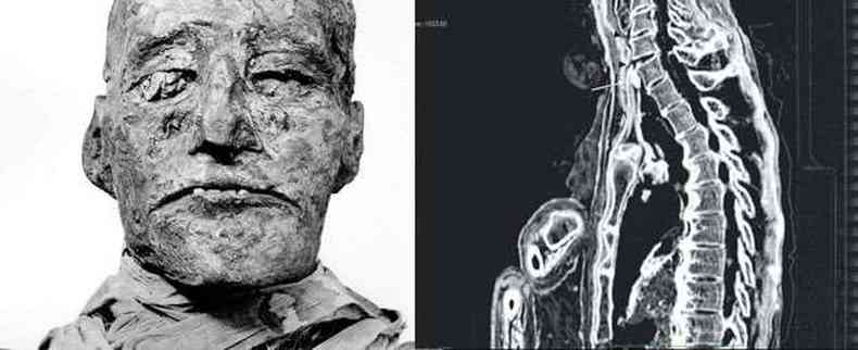 A múmia de Ramsés III e a imagem de tomografia computadorizada que permitiu a identificação do corte feito em sua garganta enquanto ainda estava vivo: vítima de uma trama para tomar o poder no antigo Egito(foto: MUSEU DO CAIRO/DIVULGAÇÃO/ ALBER ZINK/DIUVLLGAÇÃO)