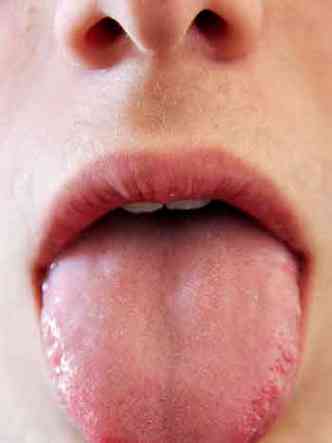 Limpeza da língua