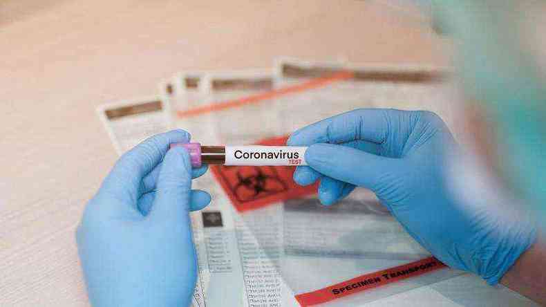 Casos de infeco pelo novo coronavrus chegaram a 33,6 mil(foto: STR/AFP)