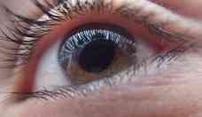 Preveno  palavra-chave para evitar cegueira causada pelo glaucoma