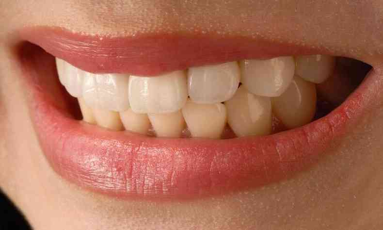 dentes de uma mulher