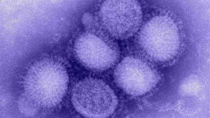 H1N1 visto de um microscpio eletrnico - uma das gripe mais perigosas da atualidade.(foto: Chinese Academy of Sciences)