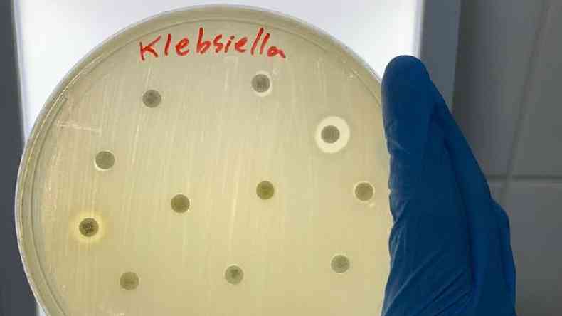 Klebsiella pneumoniae faz parte de categoria 'crtica' das bactrias contra as quais o desenvolvimento de novos remdios  mais urgente, segundo lista da OMS(foto: Divulgao)