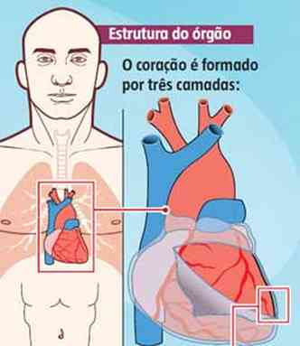 Infarto: saiba identificar seus sinais e sintomas