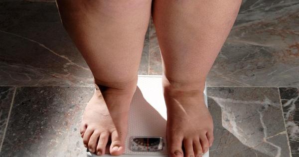 Obesidade: quando ir além do tratamento clínico e considerar a cirurgia