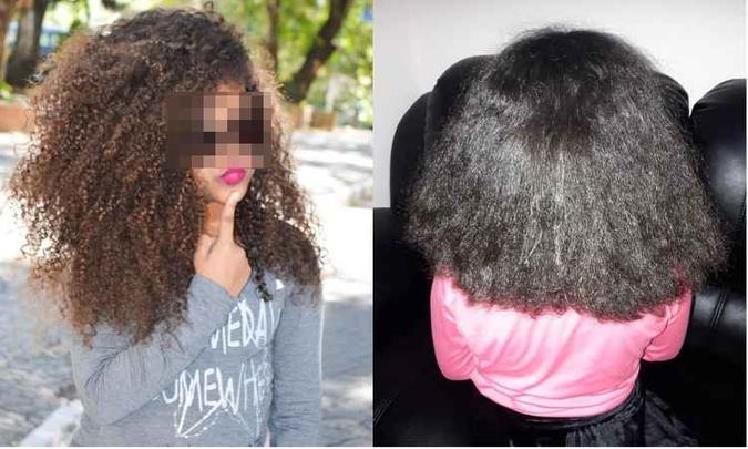 (foto: Mãe publicou fotos no Facebook do cabelo da criança antes e depois da intervenção) (foto: Mãe publicou fotos no Facebook do cabelo da criança antes e depois da intervenção)