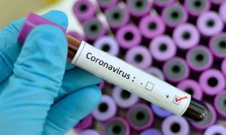 Pandemia do novo coronavrus pode gerar gasto de R$ 410 bilhes ao SUS(foto: Reproduo/ Internet)