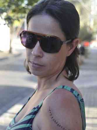 Como se recusou a pagar R$ 5 antecipadamente, a fisioterapeuta Janine Lima foi atacada na Savassi com uma esptula e levou 15 pontos no brao(foto: Juarez Rodrigues/EM/D.A PRESS)