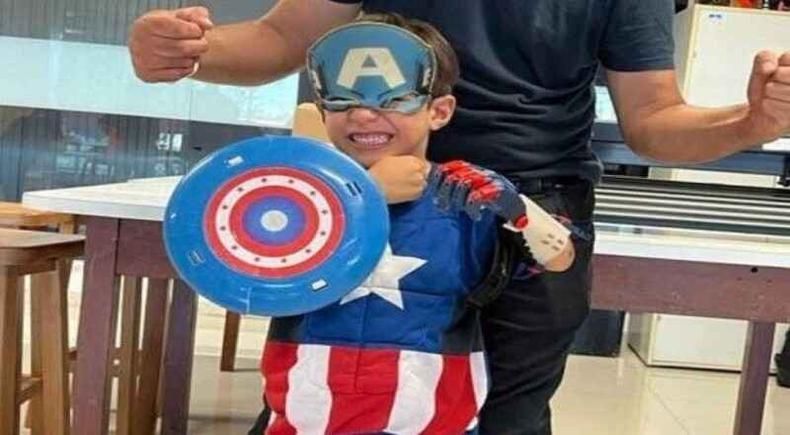 Menino de 5 anos ganha prtese do Capito Amrica. Raphael de Oliveira Batista nasceu sem a mo e a partir de agora ele poder realizar atividades do dia a dia com mais facilidade