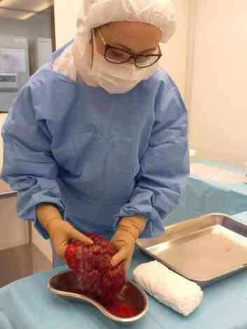 Curativo  base de placenta