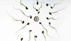 Alerta: varicocele  a principal causa de infertilidade masculina 