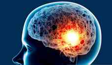Aneurisma cerebral: condio de sade pode ter consequncias devastadoras