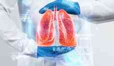 Agosto Branco: novas armas para preveno e combate ao cncer de pulmo