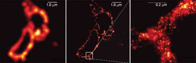 Membranas de lisossoma mostradas em um microscpio convencional (esq), em microsppio de nica molcula (centro) e por fim a imagem (dir) com resoluo muito melhor.(foto: Image from Science 313:1642%u20131645/www.nobelprize.org/divulgao)