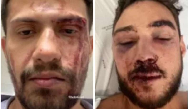 Jefferson precisou passar por uma cirurgia ao chegar ao hospital(foto: Reprodução/Redes sociais) Vítimas