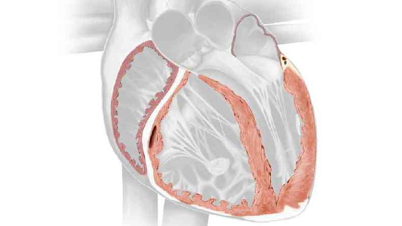 Ilustracin del Miocardio