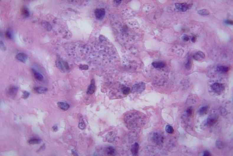 O parasita causador da leishmaniose visto do microscpio