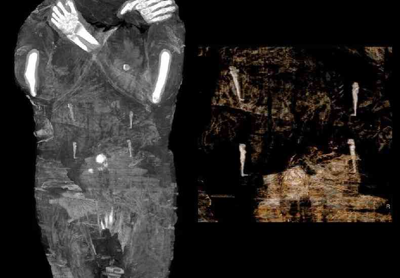 Amuletos, considerados itens conhecidos como os Quatro Filhos de Hrus, acompanham o corpo mumificado(foto: Warsaw Mummy Project)