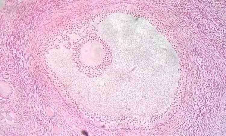 Folculos ovarianos: nveis de espermidina so mais baixos nas glndulas de animais mais velhas