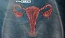 Endometriose: vdeo explica possveis causas e tratamento da doena