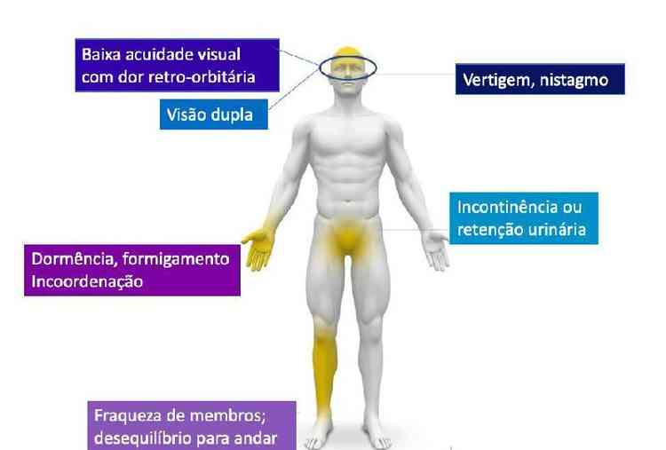 Ilustrao de sintomas da esclerose mltipla