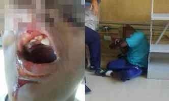 Em dezembro, criana quebrou um dos dentes. Escola disse que ele caiu. Na foto  direita, recebida pela me, menino aparece amarrado(foto: Reproduo internet/WhatsApp)