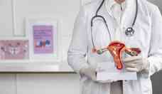  Miomas uterinos: saiba como prevenir e tratar