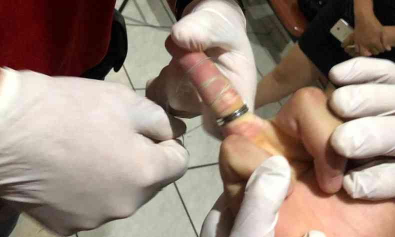 Bombeiros usaram fio dental para fazer a retirada do Anel(foto: Corpo de Bombeiros/Divulgao)