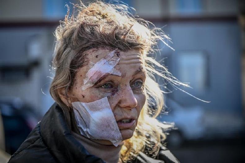 Helena, uma professora de 53 anos, do lado de fora de um hospital após o bombardeio da cidade de Chuguiv, no leste da Ucrânia, em 24 de fevereiro de 2022 (foto: AFP / Aris Messinis) Helena, uma professora de 53 anos, do lado de fora de um hospital após o bombardeio da cidade de Chuguiv, no leste da Ucrânia, em 24 de fevereiro de 2022