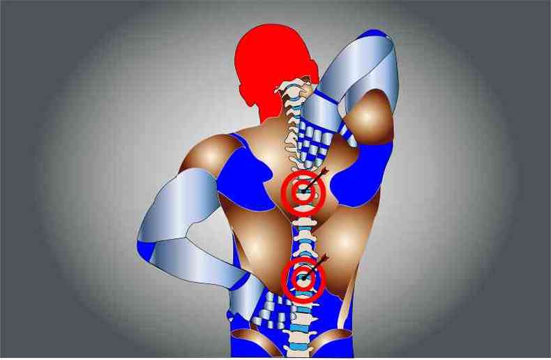 Ilustrao mostra homem com dor na coluna