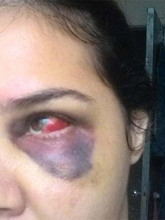 L., agredida no carnaval de BH depois de rejeitar ass�dio: 'A pol�cia n�o est� preparada'(foto: Arquivo pessoal/Divulga��o)