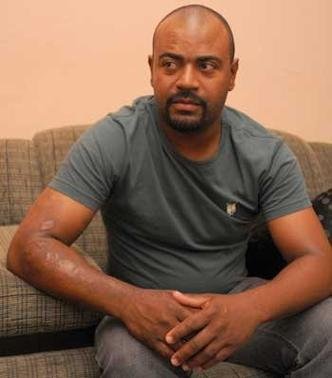 Alan sobreviveu ao inc�ndio no Canec�o Mineiro(foto: Tulio Santos/EM/D.A Press)