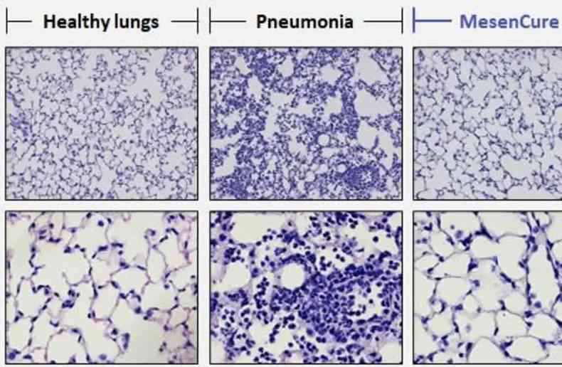 Uma imagem de laboratrio mostra um pulmo saudvel, um pulmo doente e um pulmo tratado com MesenCure(foto: The Jerusalem Post/Reproduo)